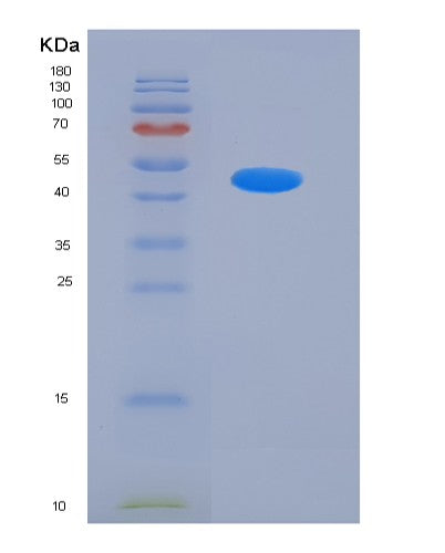 SDS-PAGE analysis of Human BACE1 (Beta-Secretase 1) - Recombinant Protein, CATHuman BACE1 (Beta-Secretase 1) - Recombinant Protein