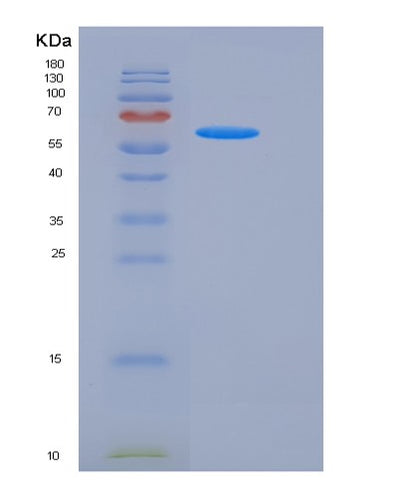SDS-PAGE analysis of Human DLL1 (Delta-Like Protein 1) - Recombinant Protein, CAT# BLT-05914P, showing >90% purity under 15% SDS-PAGE (Reduced)Human DLL1 (Delta-Like Protein 1) - Recombinant Protein