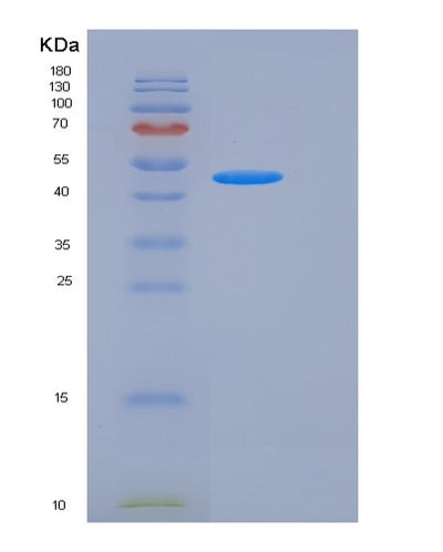 SDS-PAGE analysis of Human F11R (Junctional Adhesion Molecule A) - Recombinant Protein, CAT# BLT-05916P, showing >95% purity under 15% SDS-PAGE (Reduced)Human F11R (Junctional Adhesion Molecule A) - Recombinant Protein
