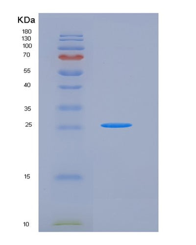 SDS-PAGE analysis of Mouse Cd86 (T-Lymphocyte Activation Antigen Cd86) - Recombinant Protein, CAT# BLT-05917P, showing >90% purity under 15% SDS-PAGE (Reduced)Mouse Cd86 (T-Lymphocyte Activation Antigen Cd86) - Recombinant Protein