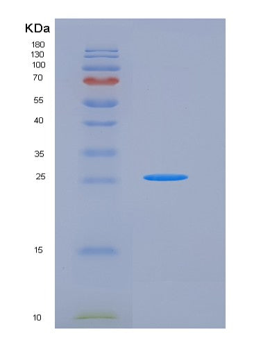 SDS-PAGE analysis of Mouse Cd86 (T-Lymphocyte Activation Antigen Cd86) - Recombinant Protein, CATMouse Cd86 (T-Lymphocyte Activation Antigen Cd86) - Recombinant Protein