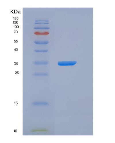 SDS-PAGE analysis of Human AGER (Advanced Glycosylation End Product-Specific Receptor) - Recombinant Protein, CAT# BLT-05924P, showing >95% purity under 15% SDS-PAGE (Reduced)Human AGER (Advanced Glycosylation End Product-Specific Receptor) - Recombinant Protein