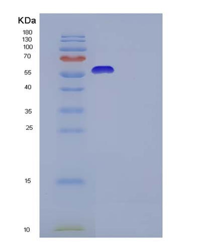 SDS-PAGE analysis of Human IL13RA2 (Interleukin-13 Receptor Subunit Alpha-2) - Recombinant Protein, CAT# BLT-05926P, showing >95% purity under 15% SDS-PAGE (Reduced)Human IL13RA2 (Interleukin-13 Receptor Subunit Alpha-2) - Recombinant Protein