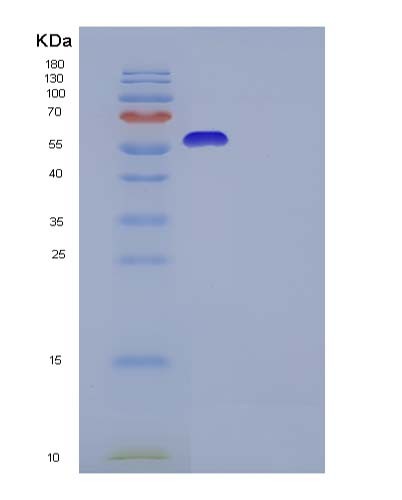SDS-PAGE analysis of Human IL13RA2 (Interleukin-13 Receptor Subunit Alpha-2) - Recombinant Protein, CATHuman IL13RA2 (Interleukin-13 Receptor Subunit Alpha-2) - Recombinant Protein