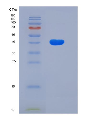 SDS-PAGE analysis of Human CD27 (Cd27 Antigen) - Recombinant Protein, CAT# BLT-05934P, showing >95% purity under 15% SDS-PAGE (Reduced)Human CD27 (Cd27 Antigen) - Recombinant Protein