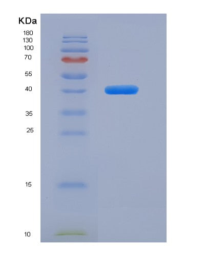SDS-PAGE analysis of Human MUC1 (Mucin-1) - Recombinant Protein, CATHuman MUC1 (Mucin-1) - Recombinant Protein