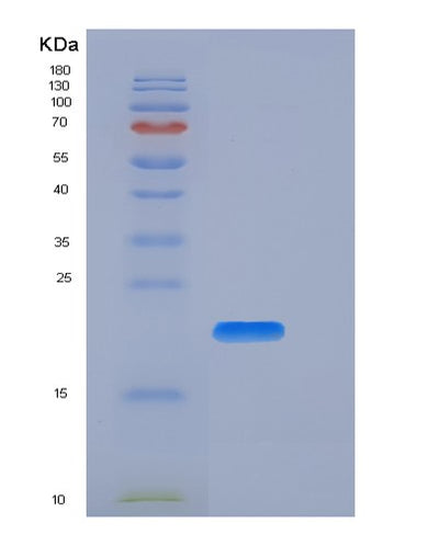 SDS-PAGE analysis of Human CD27 (Cd27 Antigen) - Recombinant Protein, CAT# BLT-05938P, showing >85% purity under 15% SDS-PAGE (Reduced)Human CD27 (Cd27 Antigen) - Recombinant Protein