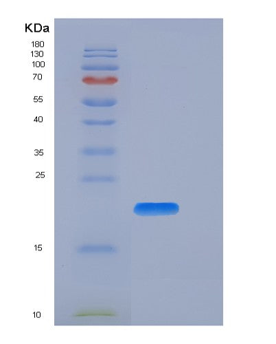 SDS-PAGE analysis of Human CD27 (Cd27 Antigen) - Recombinant Protein, CATHuman CD27 (Cd27 Antigen) - Recombinant Protein