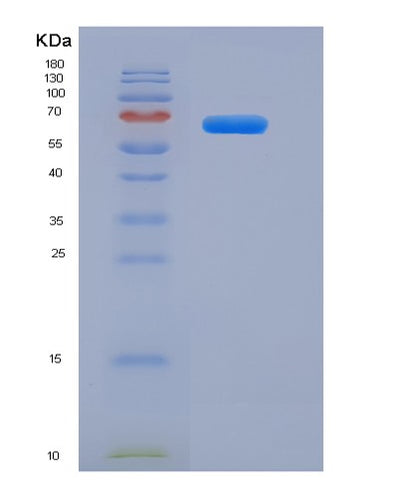 SDS-PAGE analysis of Human FGFR2 (Fibroblast Growth Factor Receptor 2) - Recombinant Protein, CAT# BLT-05939P, showing >95% purity under 15% SDS-PAGE (Reduced)Human FGFR2 (Fibroblast Growth Factor Receptor 2) - Recombinant Protein