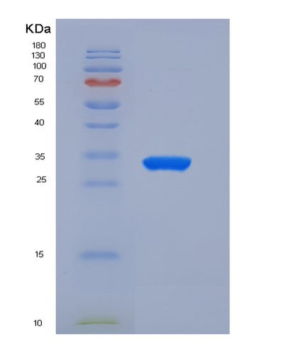 SDS-PAGE analysis of Human CEACAM6 (Cell Adhesion Molecule Ceacam6) - Recombinant Protein, CAT# BLT-05943P, showing >85% purity under 15% SDS-PAGE (Reduced)Human CEACAM6 (Cell Adhesion Molecule Ceacam6) - Recombinant Protein