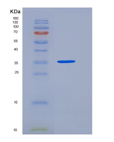 SDS-PAGE analysis of Human SIRPG (Signal-Regulatory Protein Gamma) - Recombinant Protein, CAT# BLT-05947P, showing >85% purity under 15% SDS-PAGE (Reduced)Human SIRPG (Signal-Regulatory Protein Gamma) - Recombinant Protein