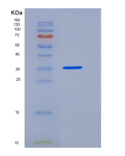 SDS-PAGE analysis of Human SIRPG (Signal-Regulatory Protein Gamma) - Recombinant Protein, CATHuman SIRPG (Signal-Regulatory Protein Gamma) - Recombinant Protein