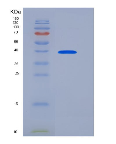 SDS-PAGE analysis of Human SIRPA (Tyrosine-Protein Phosphatase Non-Receptor Type Substrate 1) - Recombinant Protein, CAT# BLT-05948P, showing >95% purity under 15% SDS-PAGE (Reduced)Human SIRPA (Tyrosine-Protein Phosphatase Non-Receptor Type Substrate 1) - Recombinant Protein