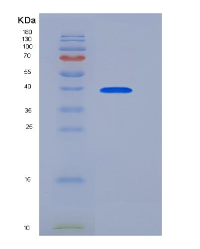 SDS-PAGE analysis of Human SIRPA (Tyrosine-Protein Phosphatase Non-Receptor Type Substrate 1) - Recombinant Protein, CATHuman SIRPA (Tyrosine-Protein Phosphatase Non-Receptor Type Substrate 1) - Recombinant Protein