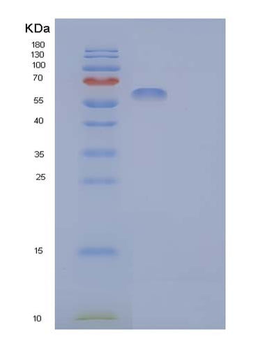 SDS-PAGE analysis of Human CDC123 (Translation Initiation Factor Eif2 Assembly Protein) - Recombinant Protein, CAT# BLT-05952P, showing >95% purity under 15% SDS-PAGE (Reduced)Human CDC123 (Translation Initiation Factor Eif2 Assembly Protein) - Recombinant Protein