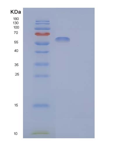 SDS-PAGE analysis of Human CDC123 (Translation Initiation Factor Eif2 Assembly Protein) - Recombinant Protein, CATHuman CDC123 (Translation Initiation Factor Eif2 Assembly Protein) - Recombinant Protein