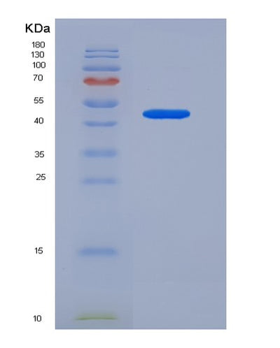 SDS-PAGE analysis of Human SERPINB3 (Serpin B3) - Recombinant Protein, CAT# BLT-05955P, showing >90% purity under 15% SDS-PAGE (Reduced)Human SERPINB3 (Serpin B3) - Recombinant Protein