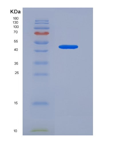 SDS-PAGE analysis of Human SERPINB3 (Serpin B3) - Recombinant Protein, CATHuman SERPINB3 (Serpin B3) - Recombinant Protein