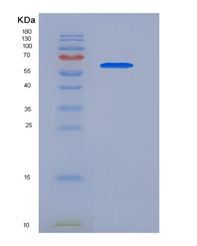 SDS-PAGE analysis of Human NECTIN1 (Nectin-1) - Recombinant Protein, CATHuman NECTIN1 (Nectin-1) - Recombinant Protein