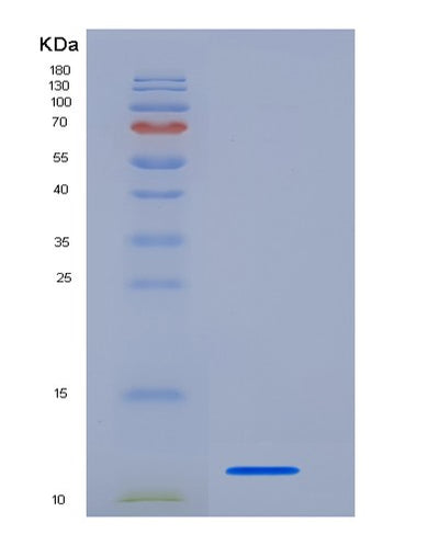SDS-PAGE analysis of Human S100A4 (Protein S100-A4) - Recombinant Protein, CAT# BLT-05957P, showing >95% purity under 15% SDS-PAGE (Reduced)Human S100A4 (Protein S100-A4) - Recombinant Protein