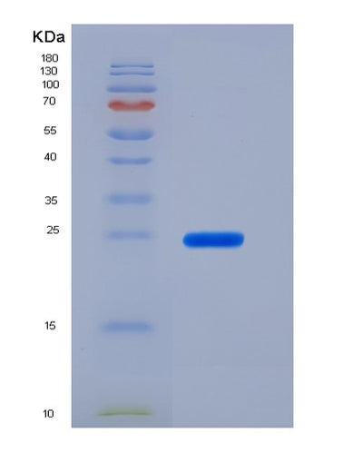 SDS-PAGE analysis of Mouse Slamf8 (Slam Family Member 8) - Recombinant Protein, CAT# BLT-05958P, showing >85% purity under 15% SDS-PAGE (Reduced)Mouse Slamf8 (Slam Family Member 8) - Recombinant Protein