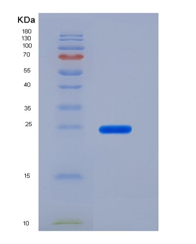 SDS-PAGE analysis of Mouse Slamf8 (Slam Family Member 8) - Recombinant Protein, CATMouse Slamf8 (Slam Family Member 8) - Recombinant Protein