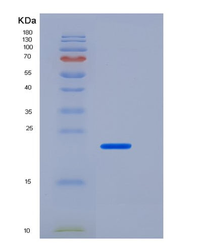 SDS-PAGE analysis of Human FTH1 (Ferritin Heavy Chain) - Recombinant Protein, CAT# BLT-05960P, showing >90% purity under 15% SDS-PAGE (Reduced)Human FTH1 (Ferritin Heavy Chain) - Recombinant Protein