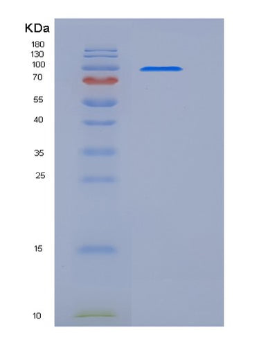 SDS-PAGE analysis of Human CR2 (Complement Receptor Type 2) - Recombinant Protein, CAT# BLT-05963P, showing >85% purity under 15% SDS-PAGE (Reduced)Human CR2 (Complement Receptor Type 2) - Recombinant Protein