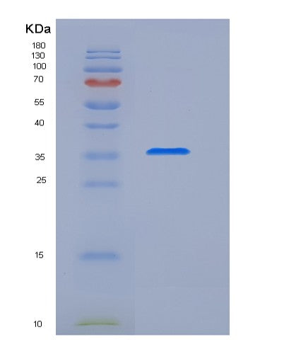SDS-PAGE analysis of Human S100B (Protein S100-B) - Recombinant Protein, CATHuman S100B (Protein S100-B) - Recombinant Protein
