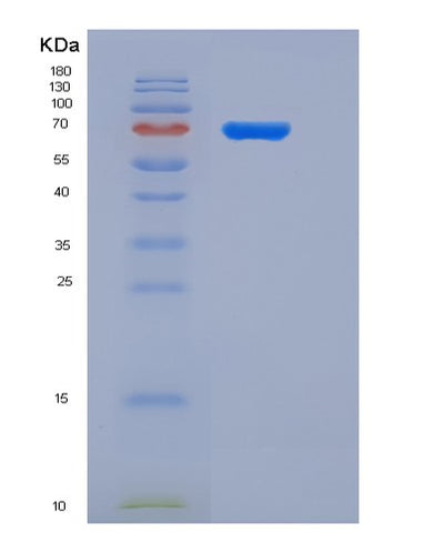 SDS-PAGE analysis of Human SEMA4A (Semaphorin-4A) - Recombinant Protein, CAT# BLT-05965P, showing >85% purity under 15% SDS-PAGE (Reduced)Human SEMA4A (Semaphorin-4A) - Recombinant Protein