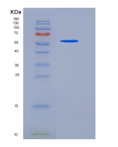 SDS-PAGE analysis of Mouse Ces2e (Pyrethroid Hydrolase Ces2E) - Recombinant Protein, CATMouse Ces2e (Pyrethroid Hydrolase Ces2E) - Recombinant Protein