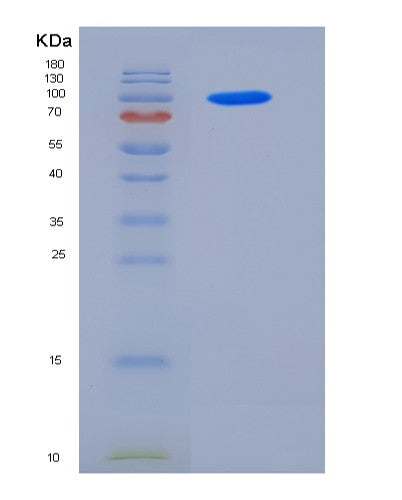 SDS-PAGE analysis of Human SEMA4A (Semaphorin-4A) - Recombinant Protein, CATHuman SEMA4A (Semaphorin-4A) - Recombinant Protein