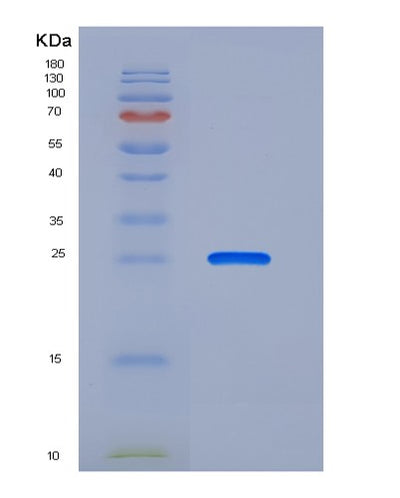 SDS-PAGE analysis of Human FCAR (Immunoglobulin Alpha Fc Receptor) - Recombinant Protein, CAT# BLT-05972P, showing >85% purity under 15% SDS-PAGE (Reduced)Human FCAR (Immunoglobulin Alpha Fc Receptor) - Recombinant Protein