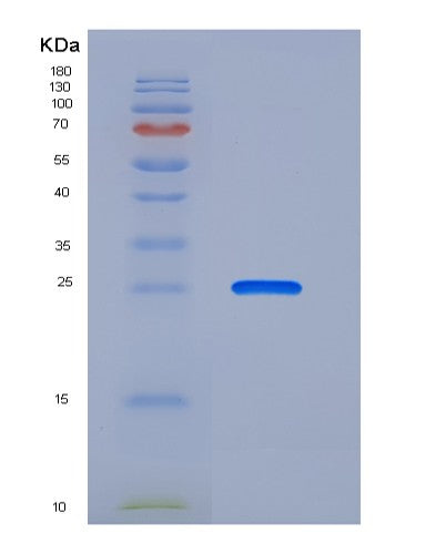 SDS-PAGE analysis of Human FCAR (Immunoglobulin Alpha Fc Receptor) - Recombinant Protein, CATHuman FCAR (Immunoglobulin Alpha Fc Receptor) - Recombinant Protein