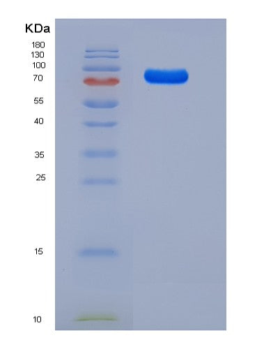 SDS-PAGE analysis of Human FLT4 (Vascular Endothelial Growth Factor Receptor 3) - Recombinant Protein, CATHuman FLT4 (Vascular Endothelial Growth Factor Receptor 3) - Recombinant Protein