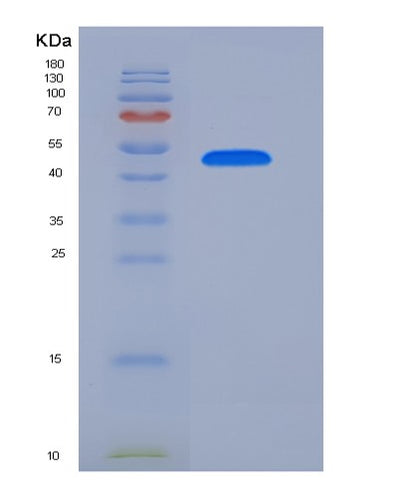 SDS-PAGE analysis of Mouse Igfbp7 (Insulin-Like Growth Factor-Binding Protein 7) - Recombinant Protein, CAT# BLT-05978P, showing >90% purity under 15% SDS-PAGE (Reduced)Mouse Igfbp7 (Insulin-Like Growth Factor-Binding Protein 7) - Recombinant Protein