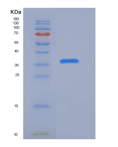 SDS-PAGE analysis of Human S100A1 (Protein S100-A1) - Recombinant Protein, CAT# BLT-05980P, showing >95% purity under 15% SDS-PAGE (Reduced)Human S100A1 (Protein S100-A1) - Recombinant Protein