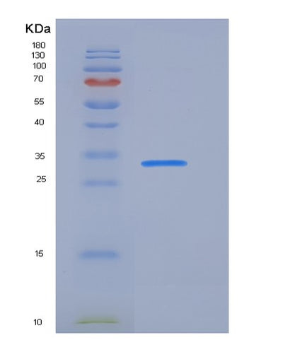 SDS-PAGE analysis of Human FCER2 (Low Affinity Immunoglobulin Epsilon Fc Receptor) - Recombinant Protein, CAT# BLT-05981P, showing >95% purity under 15% SDS-PAGE (Reduced)Human FCER2 (Low Affinity Immunoglobulin Epsilon Fc Receptor) - Recombinant Protein