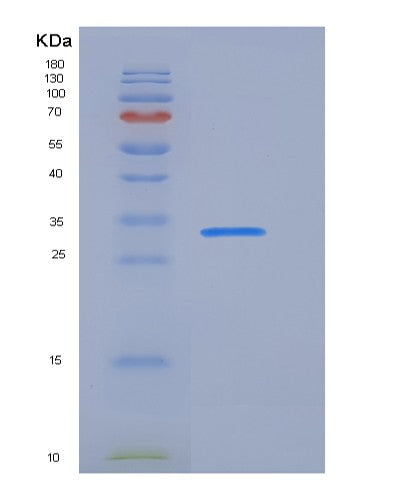 SDS-PAGE analysis of Human FCER2 (Low Affinity Immunoglobulin Epsilon Fc Receptor) - Recombinant Protein, CATHuman FCER2 (Low Affinity Immunoglobulin Epsilon Fc Receptor) - Recombinant Protein