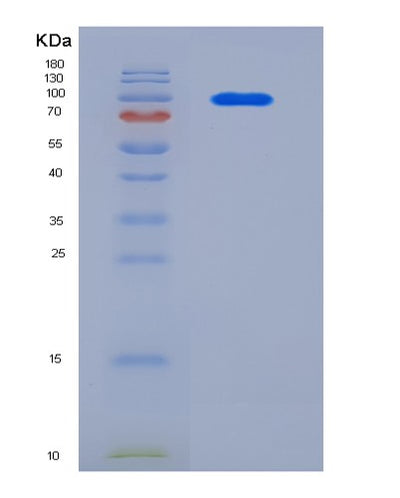 SDS-PAGE analysis of Mouse Cntn2 (Contactin-2) - Recombinant Protein, CAT# BLT-05984P, showing >85% purity under 15% SDS-PAGE (Reduced)Mouse Cntn2 (Contactin-2) - Recombinant Protein