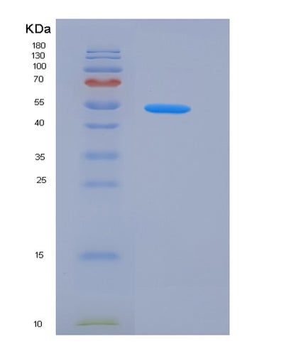 SDS-PAGE analysis of Human CXADR (Coxsackievirus And Adenovirus Receptor) - Recombinant Protein, CAT# BLT-05991P, showing >95% purity under 15% SDS-PAGE (Reduced)Human CXADR (Coxsackievirus And Adenovirus Receptor) - Recombinant Protein