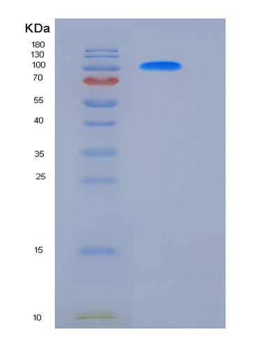 SDS-PAGE analysis of Mouse Ctnnb1 (Catenin Beta-1) - Recombinant Protein, CAT# BLT-05995P, showing >85% purity under 15% SDS-PAGE (Reduced)Mouse Ctnnb1 (Catenin Beta-1) - Recombinant Protein