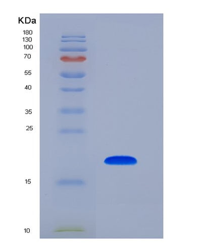 SDS-PAGE analysis of Human LCN1 (Lipocalin-1) - Recombinant Protein, CAT# BLT-06000P, showing >90% purity under 15% SDS-PAGE (Reduced)Human LCN1 (Lipocalin-1) - Recombinant Protein
