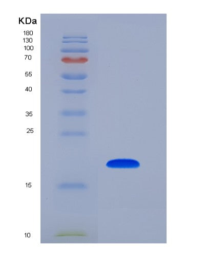 SDS-PAGE analysis of Human LCN1 (Lipocalin-1) - Recombinant Protein, CATHuman LCN1 (Lipocalin-1) - Recombinant Protein