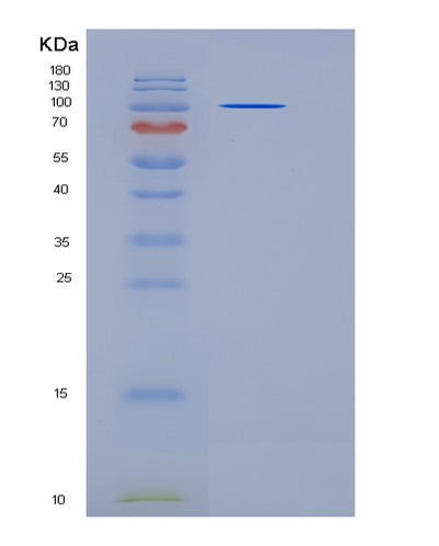 SDS-PAGE analysis of Human CNTN3 (Contactin-3) - Recombinant Protein, CAT# BLT-06003P, showing >85% purity under 15% SDS-PAGE (Reduced)Human CNTN3 (Contactin-3) - Recombinant Protein