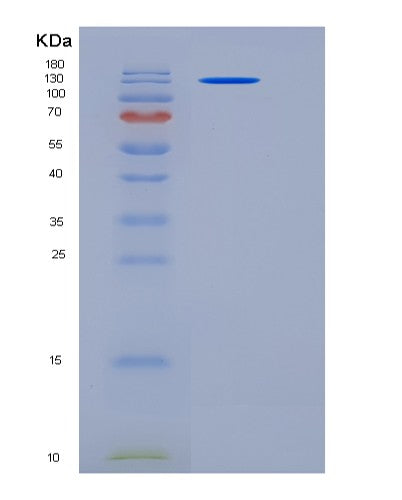 SDS-PAGE analysis of Human CNTN3 (Contactin-3) - Recombinant Protein, CATHuman CNTN3 (Contactin-3) - Recombinant Protein
