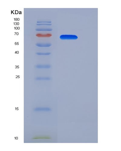 SDS-PAGE analysis of Human EPHA7 (Ephrin Type-A Receptor 7) - Recombinant Protein, CAT# BLT-06019P, showing >90% purity under 15% SDS-PAGE (Reduced)Human EPHA7 (Ephrin Type-A Receptor 7) - Recombinant Protein