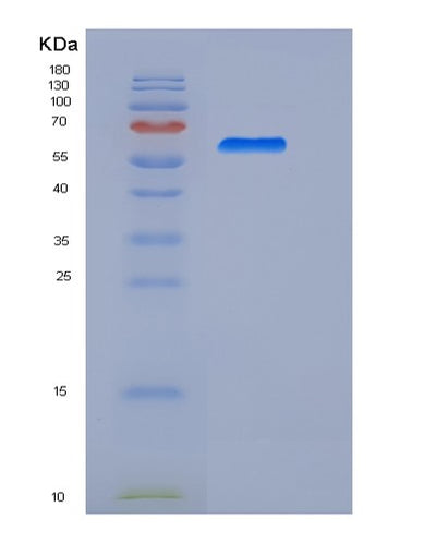 SDS-PAGE analysis of Human MSLN (Mesothelin) - Recombinant Protein, CAT# BLT-06027P, showing >95% purity under 15% SDS-PAGE (Reduced)Human MSLN (Mesothelin) - Recombinant Protein
