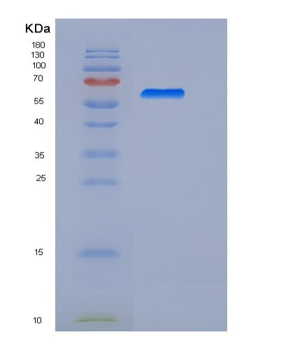 SDS-PAGE analysis of Human MSLN (Mesothelin) - Recombinant Protein, CATHuman MSLN (Mesothelin) - Recombinant Protein