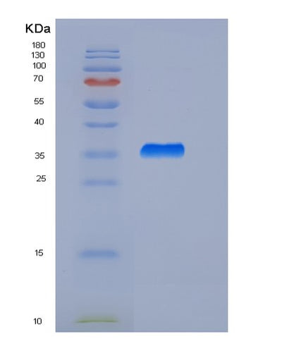 SDS-PAGE analysis of Human ARG1 (Arginase-1) - Recombinant Protein, CAT# BLT-06028P, showing >90% purity under 15% SDS-PAGE (Reduced)Human ARG1 (Arginase-1) - Recombinant Protein